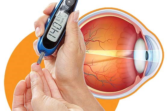 کاهش دید گذرا، اتفاقی شایع در مبتلایان به دیابت